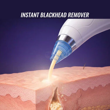 4 In 1 Multi-Function Blackhead Remover With Free Mens Trimmer (BHRT4) - Image 5
