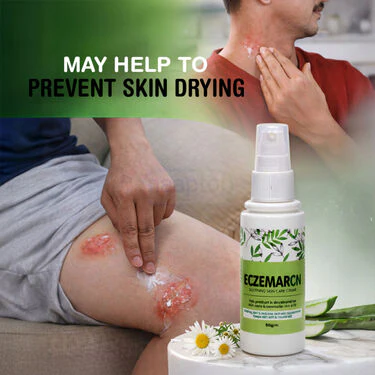 Fungal Care Cream For Eczema (BCER) - Image 2