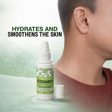 Fungal Care Cream For Eczema (BCER) - Image 3