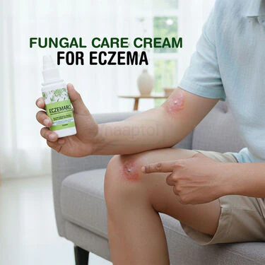 Fungal Care Cream For Eczema (BCER) - Image 4