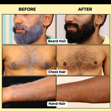 No Stain No Grey Hair Colour Shampoo For Men - Image 7
