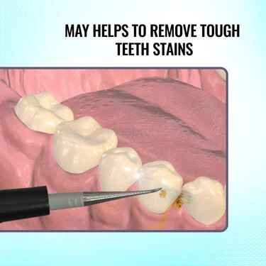 Ultrasonic Teeth Stain Remover (ETSE) - Image 2